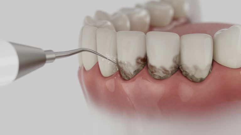 Trusted Root Canal Treatment service in Tower Lakes, IL - Dentist Open Now